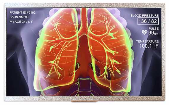 NEWHAVEN DISPLAY NHD-10.1-1024600AF-LSXV#-C